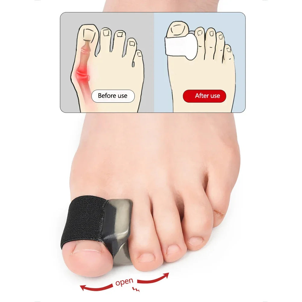 1Pair Hallux Valgus Appliance Daily Wear Silicone Foot Hallux Valgus Braces Elastic Toe Straightener Corrector for Foot Supplies Beauty Trend Shop