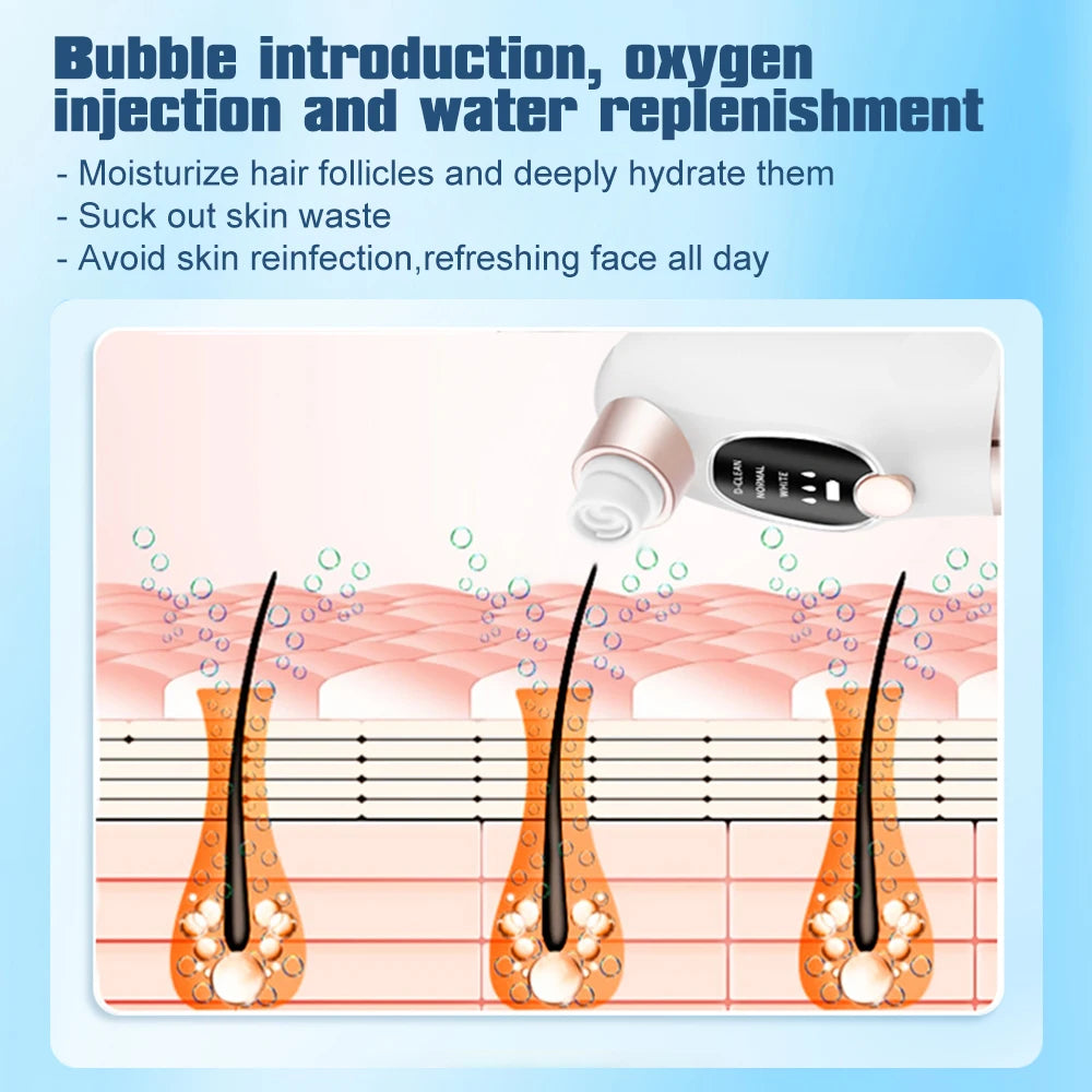 Electric Blackhead Remover Pore Vacuum Cleaner Facial Black Dots Vacuum Cleaner Acne Pimple Blackhead Removal Black Dots Remover Beauty World Shop