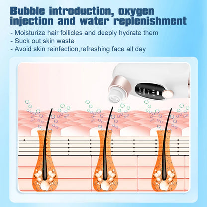 Electric Blackhead Remover Pore Vacuum Cleaner Facial Black Dots Vacuum Cleaner Acne Pimple Blackhead Removal Black Dots Remover Beauty World Shop