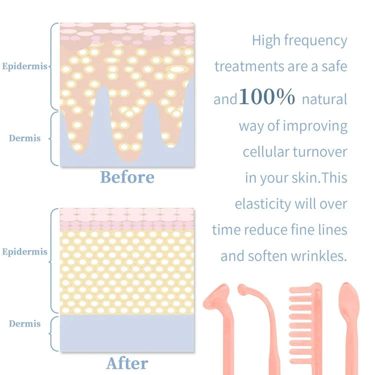 4 In 1 Handheld Electric For Face Skin Beauty Tools Portable High Frequency Facial Therapy Wand Acne Treatment Machine Neon Wand Beauty World Shop