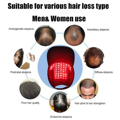 LED Red Light Therapy Cap Hair Growth Helmet Diode LaserHat Light Therapy Cap for Hair Regrowth and Hair Loss Treatment
