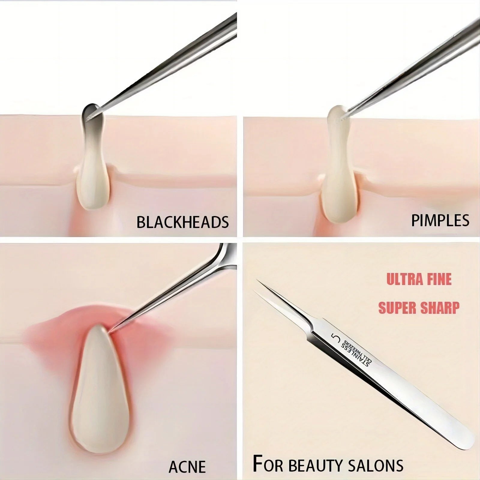 1 Pack Extra Fine No. 5 Cellular Acne Blackhead Tweezers - Facial Beauty Remove Acne Needle Tools for Skin Care Beauty World Shop