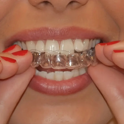 Silicone Mouth Guard Teeth Protector Night Guard Mouth Tray for Bruxism Grinding Non-snoring Teeth Whitening Protection Beauty World Shop