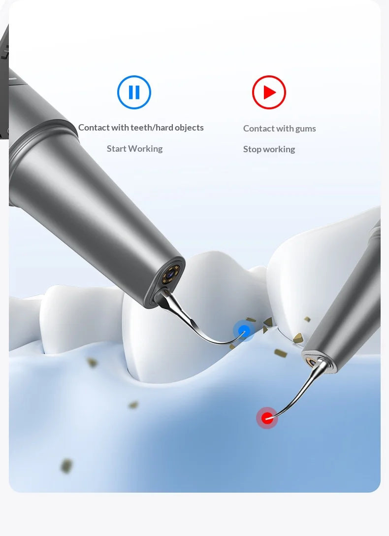 HOMEFISH Home Dental Cleaning Device Professional Tool for Removing Tartar Plaque And Calculus with Visual Technology Beauty World Shop