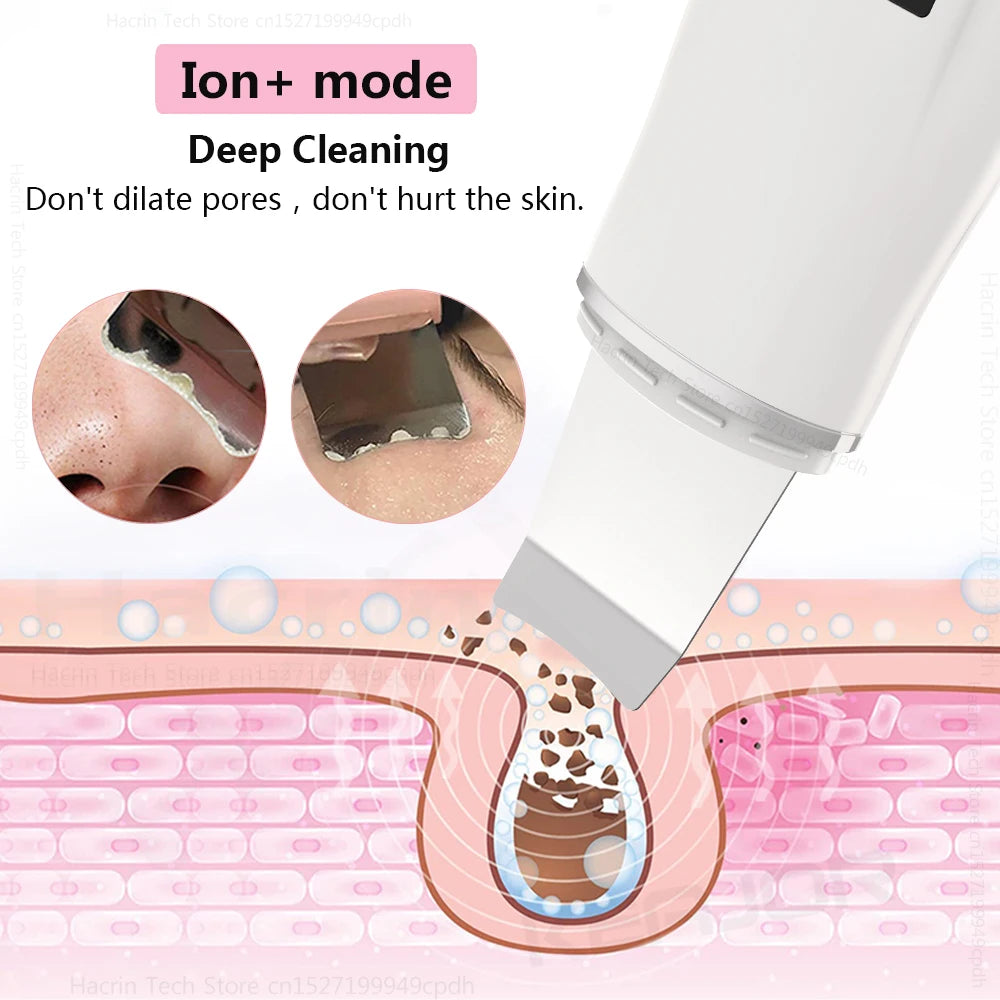 Ultrasonic Face Scrubber Facial Peeling Skin Scrubber Deep Facial Cleaning Spatula Acne Pore Ultrasonic Scrubber Facial Cleanser Beauty World Shop