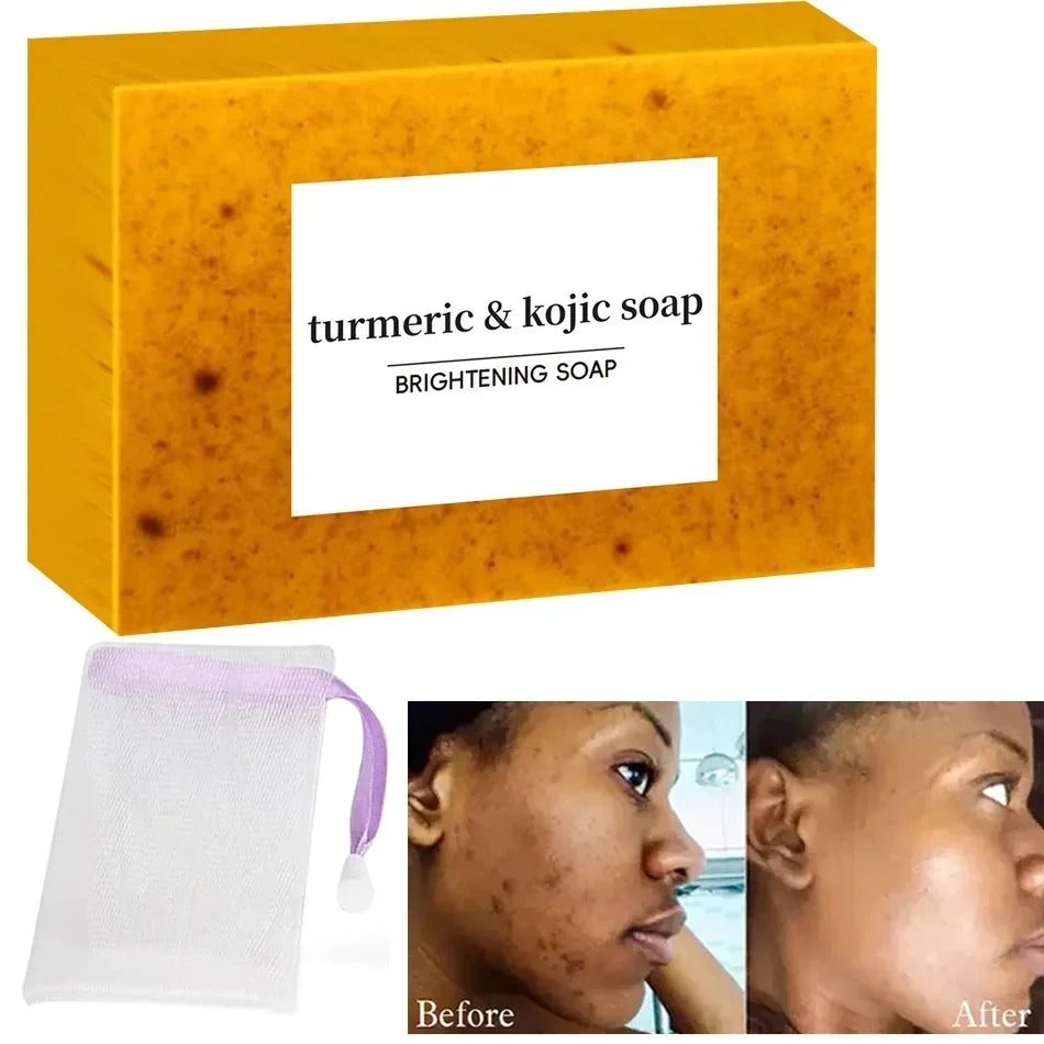 Turmeric Kojic Acid Glow Soap Dark Spot Acne Removal Even Skin Tone Mositen Smooth Skin Deep Cleansing Handmade Soap Beauty Trend Shop