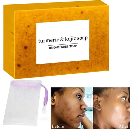 Turmeric Kojic Acid Glow Soap Dark Spot Acne Removal Even Skin Tone Mositen Smooth Skin Deep Cleansing Handmade Soap Beauty Trend Shop