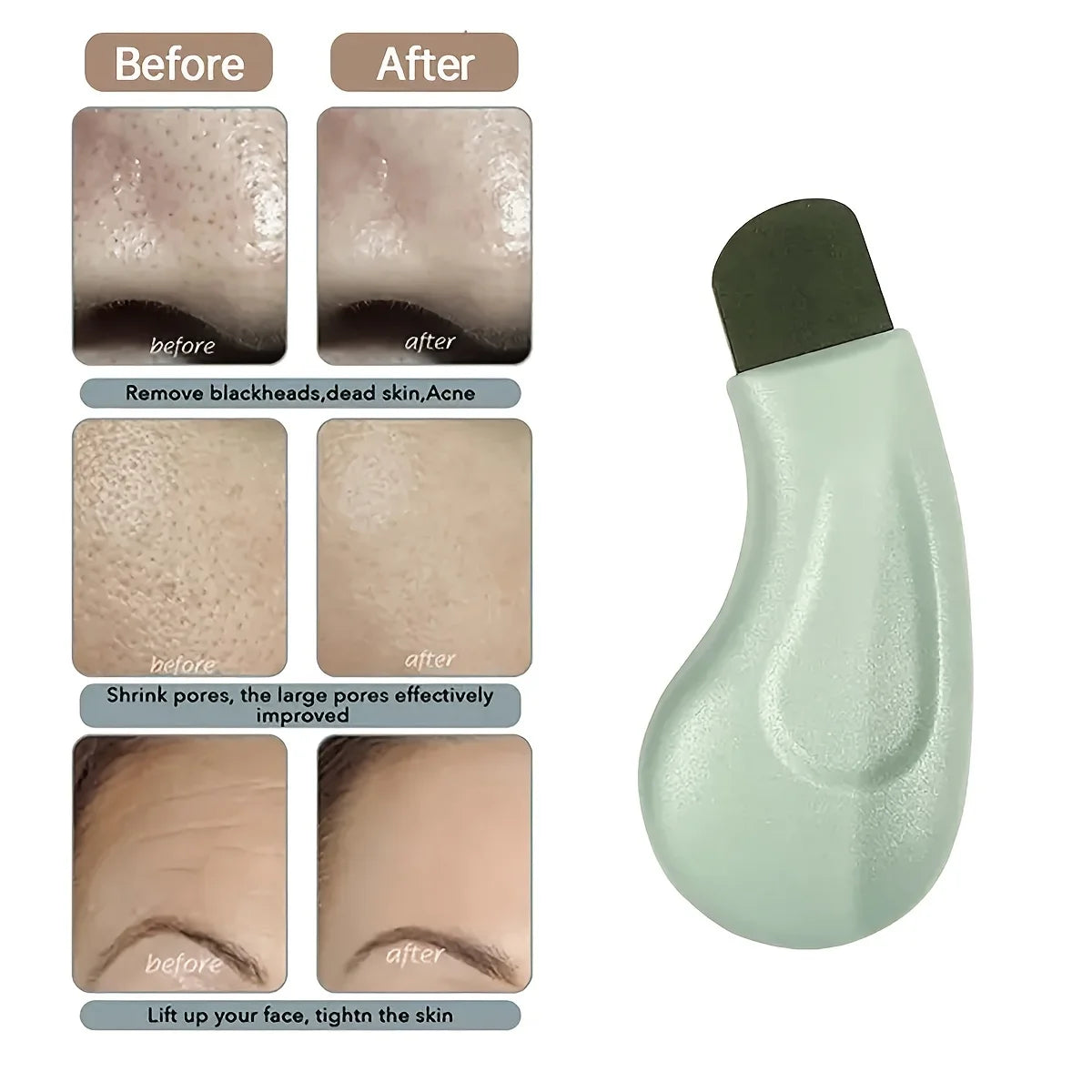 Blackhead Removal Tool, Nasal Facial Skin Cleaning Tool, Beauty Care Tool Beauty World Shop