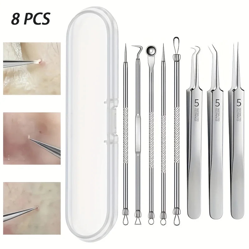 8-Piece Blackhead Remover Kit – Stainless Steel Blemish & Acne Extraction Tools – Professional Pimple Popper Set for All Skin Beauty World Shop