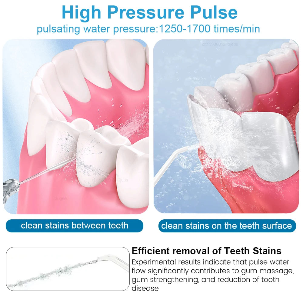 Oral Irrigator Dental Water Flosser for Teeth High Pressure Electric Dental Irrigator Water Flosser Mouth Washing Machine 800ML Beauty World Shop