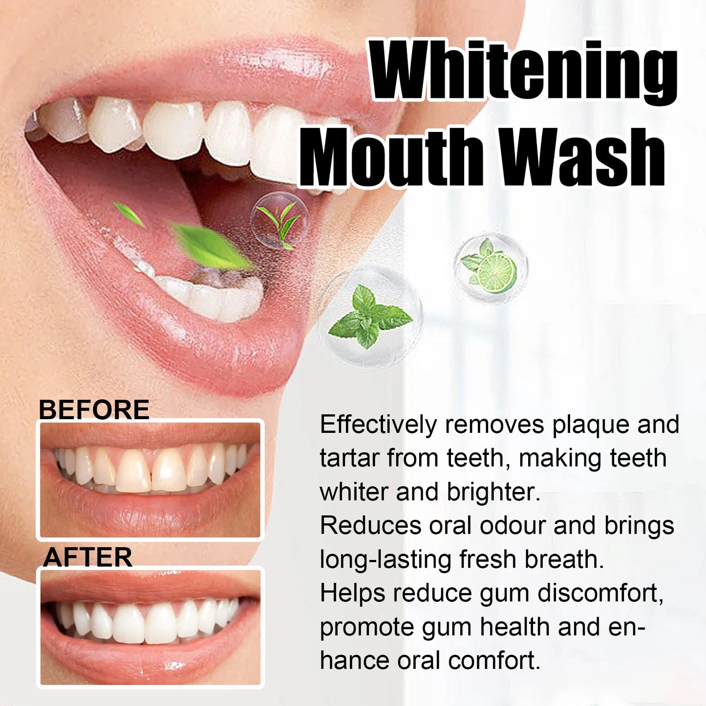 Gum Repair Drops Relieve Receding Gingival Swelling Gum Cleaning Care Oral Periodontal Hygiene Remove Yellow Remove Stain