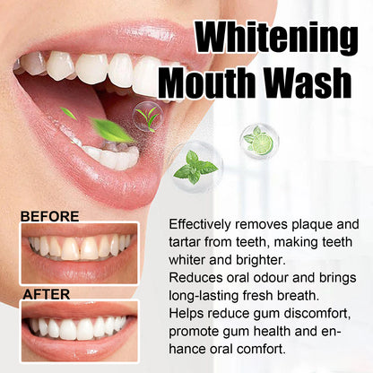 Gum Repair Drops Relieve Receding Gingival Swelling Gum Cleaning Care Oral Periodontal Hygiene Remove Yellow Remove Stain