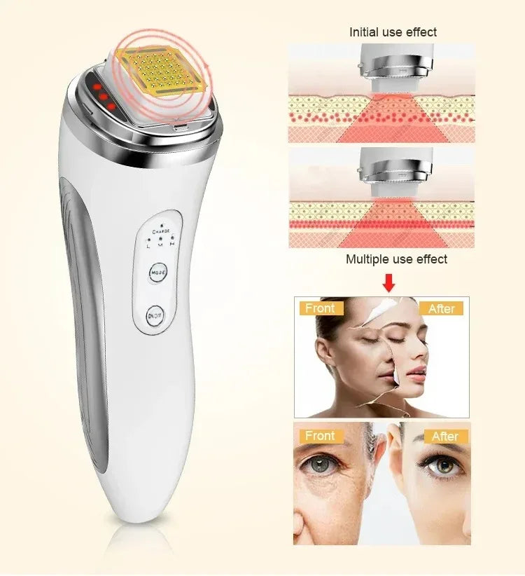 Electric Facial Lifting Machine Dot Matrix Skin Tightening Rejuvenation Wrinkle Removal Face Massager Home Use Beauty Devices Beauty World Shop