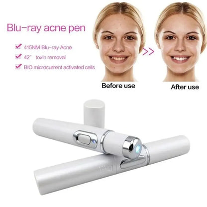 Blue Light Therapy Acne Laser Pen,LED Face Light Therapy For Scar Wrinkle Removal Treatment Device,Skin Care Beauty Appliances Beauty World Shop
