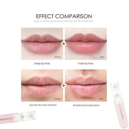 105 Pins Derma Needl Roller Beard Growth Beard Hair Growth 0.2mm/0.25mm/0.3mm Titanium Needle Beautify Lip Treatment Skin Care Beauty World Shop