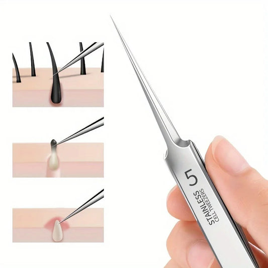 Easy-To-Use Stainless Steel Acne Extractor Set - Hypoallergenic Beauty Tweezers For Clear Skin, Perfect For Beginners Beauty Fashion