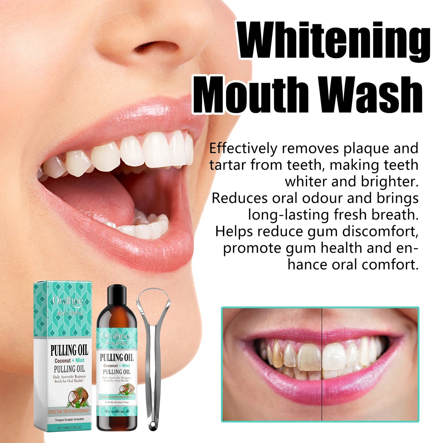 Gum Repair Drops Relieve Receding Gingival Swelling Gum Cleaning Care Oral Periodontal Hygiene Remove Yellow Remove Stain