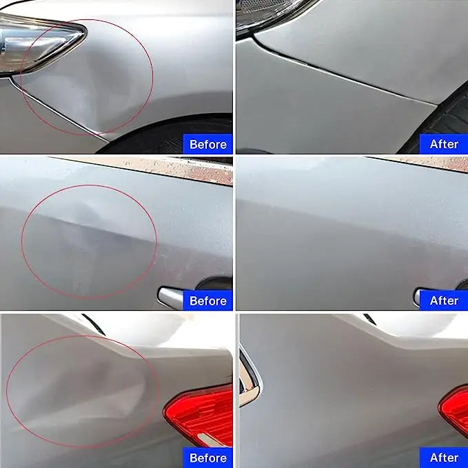 Car Body Sheet Metal Paintless Dent Plastic Puller Kit Auto Hail Pit Removal Repair Tools Hot Multiple Sizes Suction Cup Set Beauty World Shop