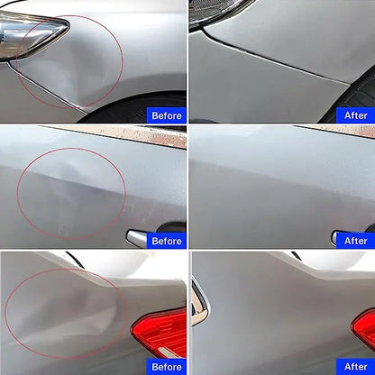 Car Body Sheet Metal Paintless Dent Plastic Puller Kit Auto Hail Pit Removal Repair Tools Hot Multiple Sizes Suction Cup Set Beauty World Shop