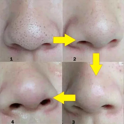 Blackhead Nose Patch Deep Cleansing, Nose Spots, Facial Spot Patch, Quickly Removes Blackheads, Restores Fresh Nose Beauty World Shop