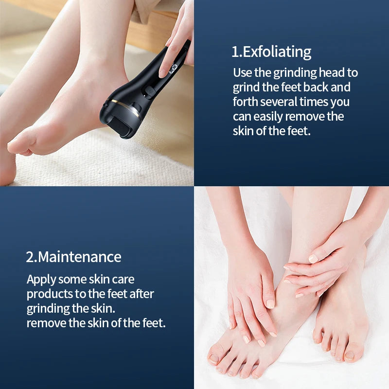Rechargeable Electric Foot Grinder - USB Powered Callus Remover with Adjustable Speeds, for Men & Women's Pedicure and Self-Care Beauty World Shop
