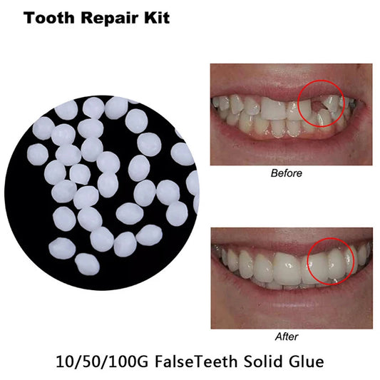 5/10/20/50/100g Dental Resin Shapeable Teeth Glue Temporary Filling Teeth Repair Makeup Dental Material Particles Beauty World Shop