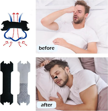 30/90/150, Anti Snoring Nose Patch Set Extra Strength Nasal Strips Better Breathing Non-Invasive Easier Breath Sleep Aid Decive Beauty World Shop