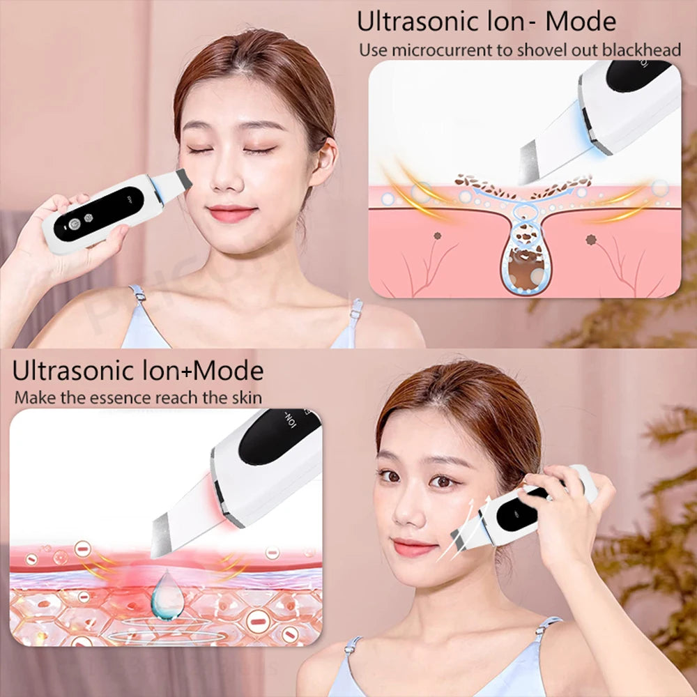Ultrasonic Skin Scrubber Facial Peeling Face Scrubber Blackhead Remover Ance Pore Deep Facial Cleaning Spatula Facial Cleanser Beauty World Shop