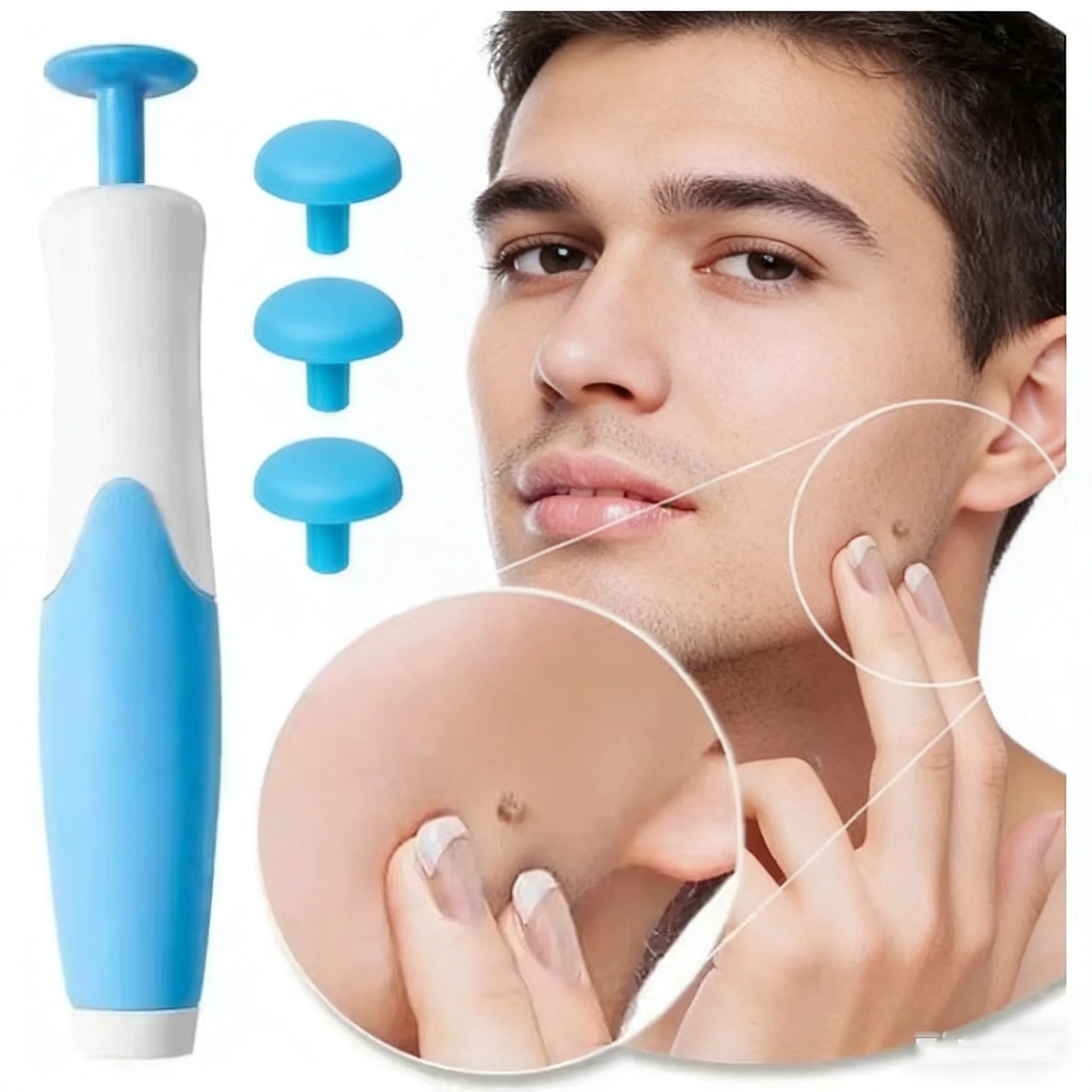 2 In 1 Face Mole Removal Tool Kits,Rubber Rings,Face Beauty Accessories Wart Tag Remover Kit  Supplies Body Wart Dot Treatments Beauty World Shop