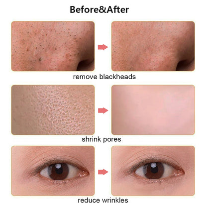Ultrasonic Face Scrubber Facial Peeling Skin Scrubber Deep Facial Cleaning Spatula Acne Pore Ultrasonic Scrubber Facial Cleanser Beauty World Shop