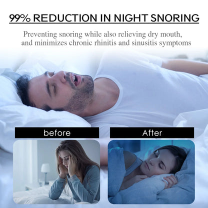 Stop Snoring Patch Nose Breathing Correction Improve Sleeping Promoting Better Breath Portable Night Sleep Mouth Orthosis Tape Beauty Trend Shop