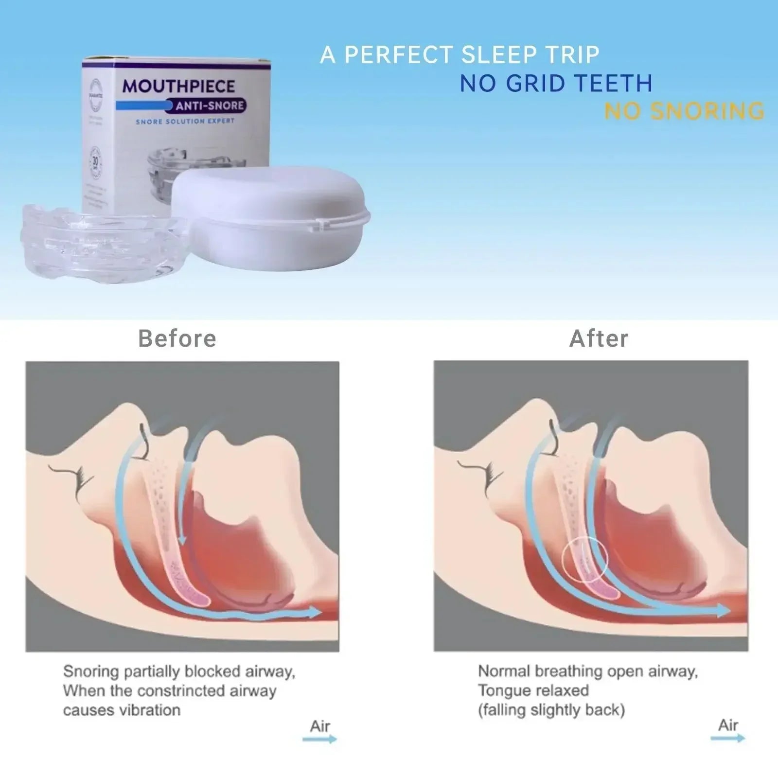 Adjustable Anti-Snoring Mouth Guard  Mouthpiece Sleeping Devices Bruxism Snoring Stopper Improve Sleep Mouthpiece Beauty Trend Shop