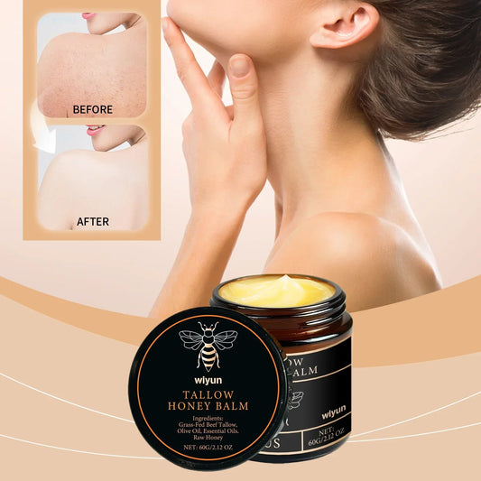 Organic Grass-Fed Beef Tallow Balm with Raw Honey - Moisturizing Cream for Soft, Smooth Skin - Handmade All-Natural Moisturizer Beauty Trend Shop