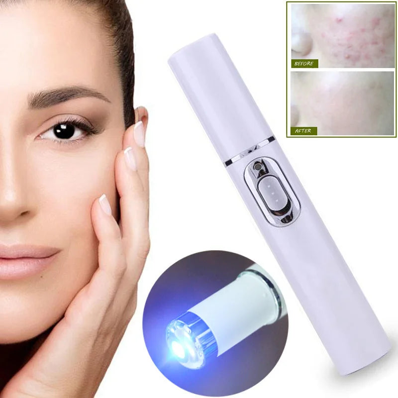 Blue Light Therapy Acne Laser Pen,LED Face Light Therapy For Scar Wrinkle Removal Treatment Device,Skin Care Beauty Appliances Beauty World Shop