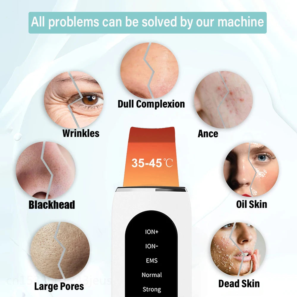 Ultrasonic Skin Scrubber Facial Peeling Face Scrubber Blackhead Remover Ance Pore Deep Facial Cleaning Spatula Facial Cleanser Beauty World Shop