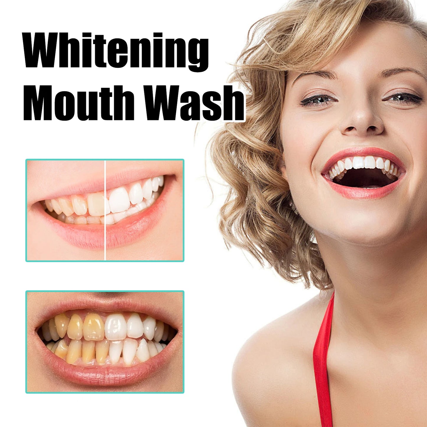 Gum Repair Drops Relieve Receding Gingival Swelling Gum Cleaning Care Oral Periodontal Hygiene Remove Yellow Remove Stain