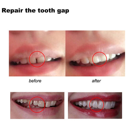 5/10/20/50/100g Dental Resin Shapeable Teeth Glue Temporary Filling Teeth Repair Makeup Dental Material Particles Beauty World Shop