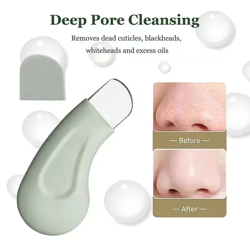 Blackhead and Whitehead Removal Tool for Nose and Face Skin Pore Cleaner Skin Care Tools for Women Beauty World Shop
