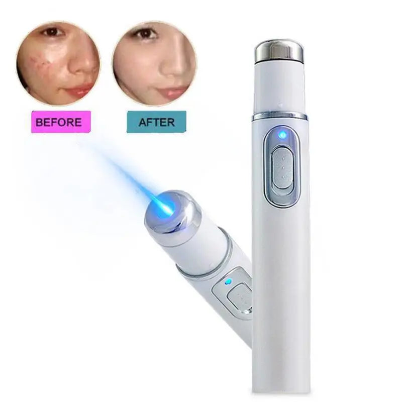 Blue Light Therapy Acne Laser Pen,LED Face Light Therapy For Scar Wrinkle Removal Treatment Device,Skin Care Beauty Appliances Beauty World Shop