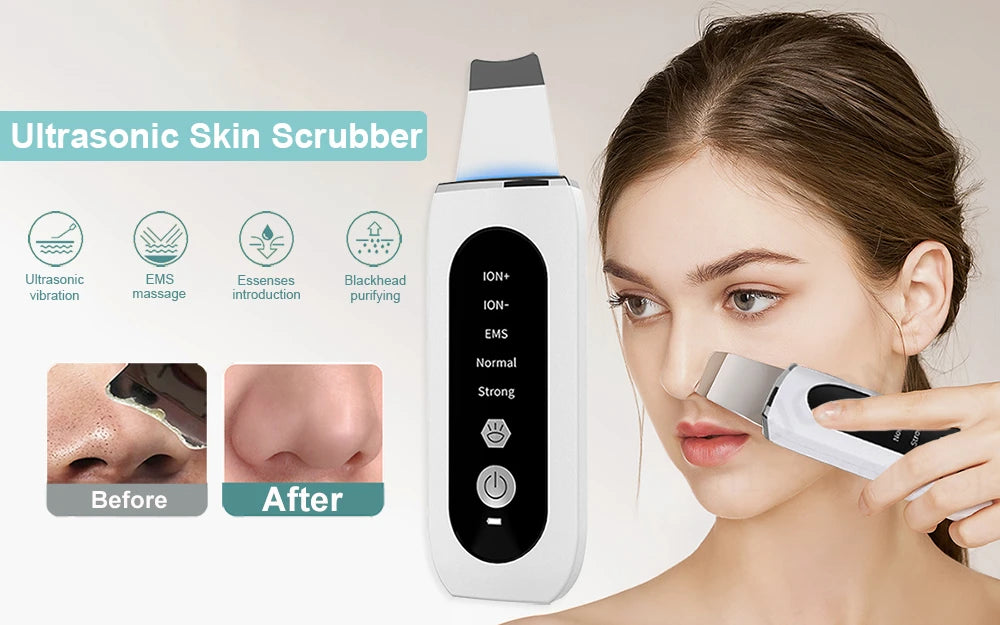 Ultrasonic Skin Scrubber Facial Peeling Face Scrubber Blackhead Remover Ance Pore Deep Facial Cleaning Spatula Facial Cleanser Beauty World Shop