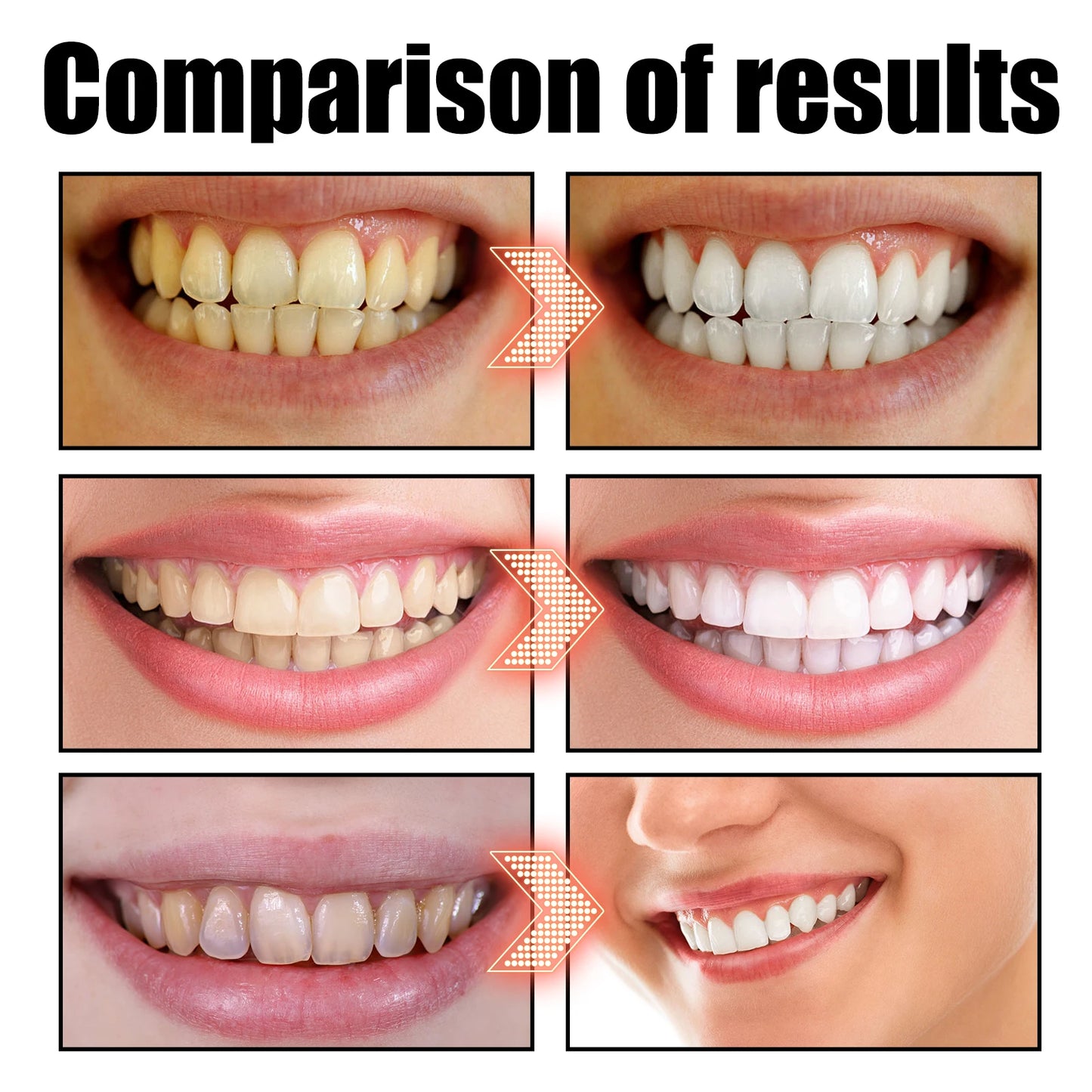 Gum Repair Drops Relieve Receding Gingival Swelling Gum Cleaning Care Oral Periodontal Hygiene Remove Yellow Remove Stain