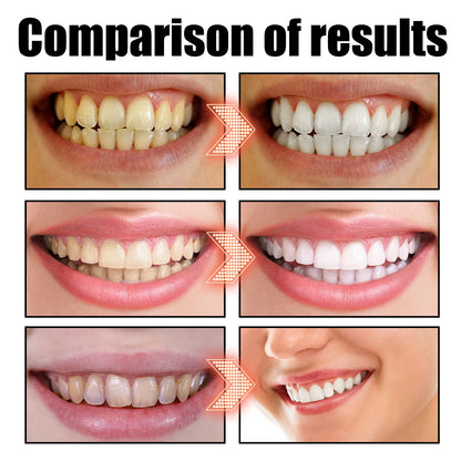 Gum Repair Drops Relieve Receding Gingival Swelling Gum Cleaning Care Oral Periodontal Hygiene Remove Yellow Remove Stain