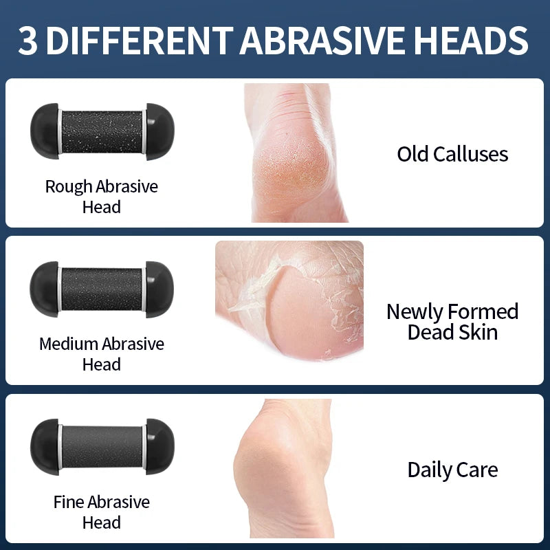 Rechargeable Electric Foot Grinder - USB Powered Callus Remover with Adjustable Speeds, for Men & Women's Pedicure and Self-Care Beauty World Shop