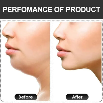 U Shape Jaw Exerciser New Facial Pop N Go Mouth Jawline Face Fitness Muscle Chew Ball Bite Breaker Training Equipment Beauty World Shop