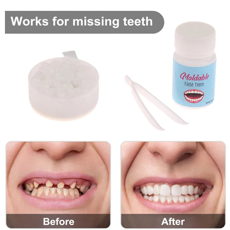 10g-30g Temporary Tooth Repair Kit Teeth And Gaps FalseTeeth Solid Glue Denture Adhesive Teeth Whitening Tooth Beauty Tool Beauty World Shop