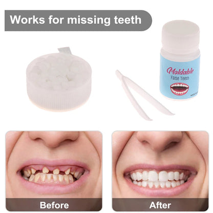 10g-30g Temporary Tooth Repair Kit Teeth And Gaps FalseTeeth Solid Glue Denture Adhesive Teeth Whitening Tooth Beauty Tool Beauty World Shop