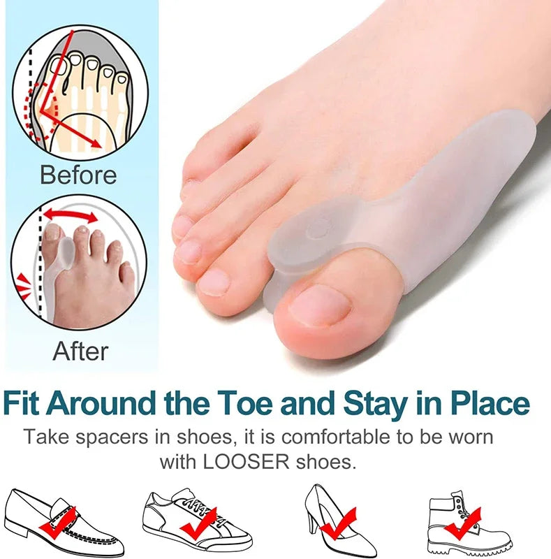 Get Relief from Bunions with 2pcs Soft Big Toe Corrector - Perfect for Night and Home Use, Long-term Comfort Beauty Trend Shop