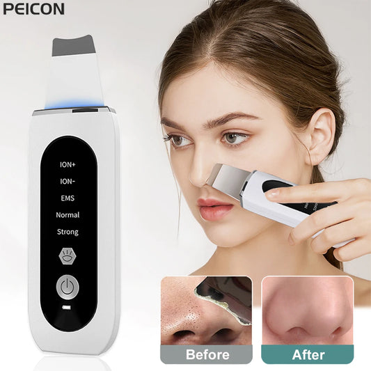 Ultrasonic Skin Scrubber Facial Peeling Face Scrubber Blackhead Remover Ance Pore Deep Facial Cleaning Spatula Facial Cleanser Beauty World Shop