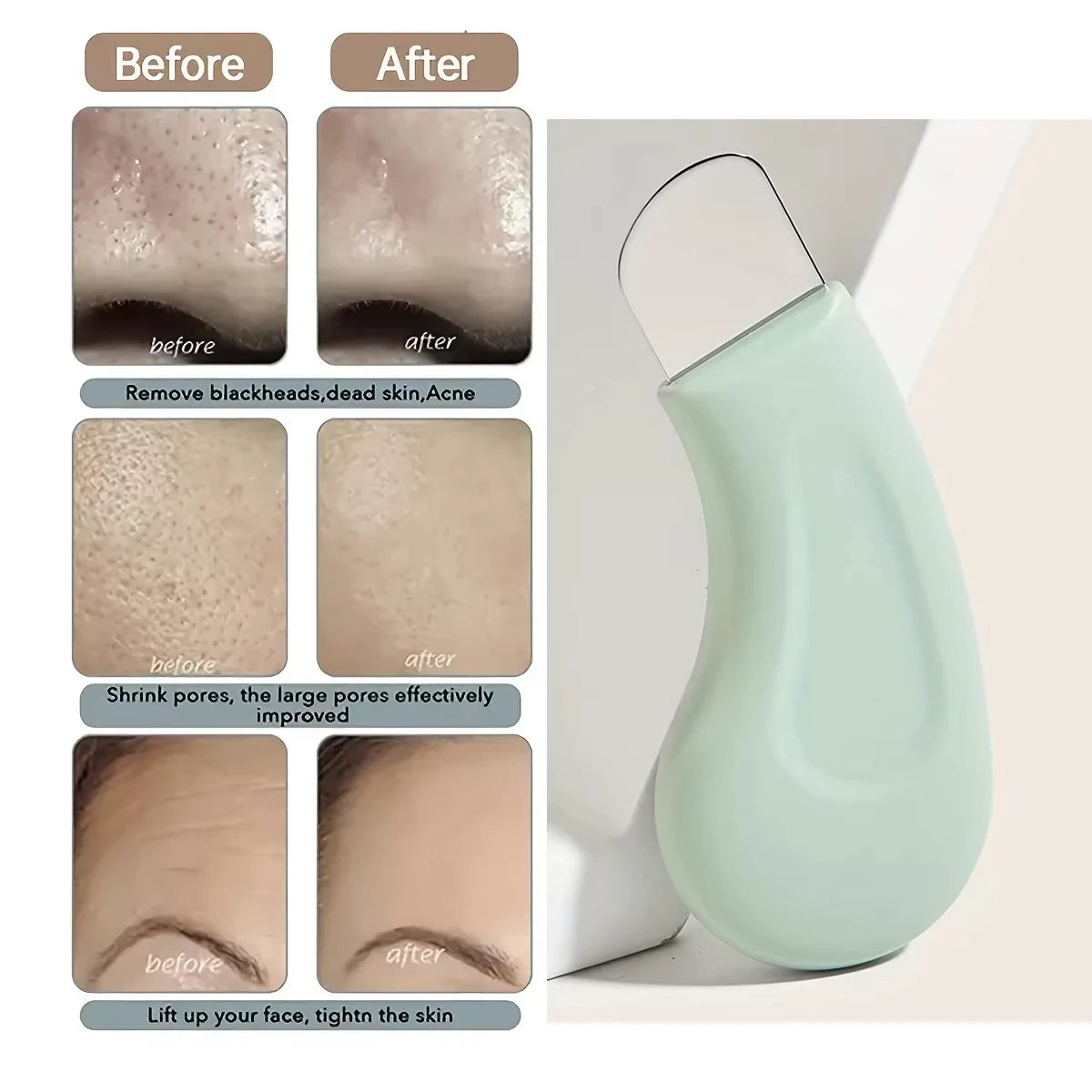 Blackhead and Whitehead Removal Tool for Nose and Face Skin Pore Cleaner Skin Care Tools for Women Beauty World Shop