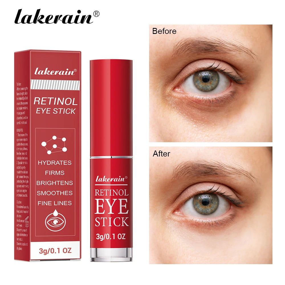 Lakerain Retinol Eye Cream Stick Moisturizing, firming Removing Eye Bags Lightening Lines And Smoothing Dark Circles Eye Cream Beauty World Shop
